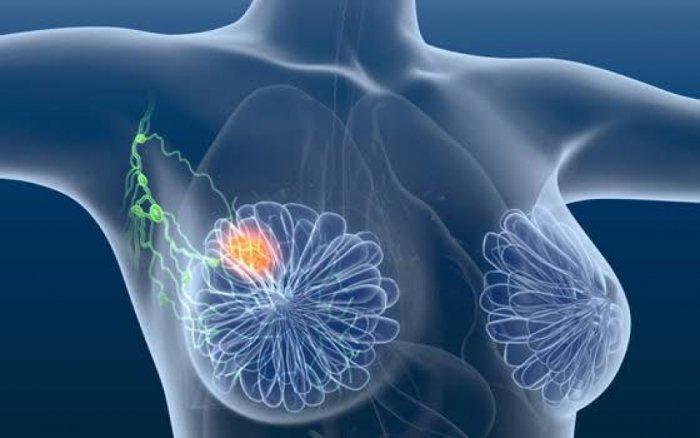 Especialistas alertam para importância do diagnóstico precoce do câncer de mama